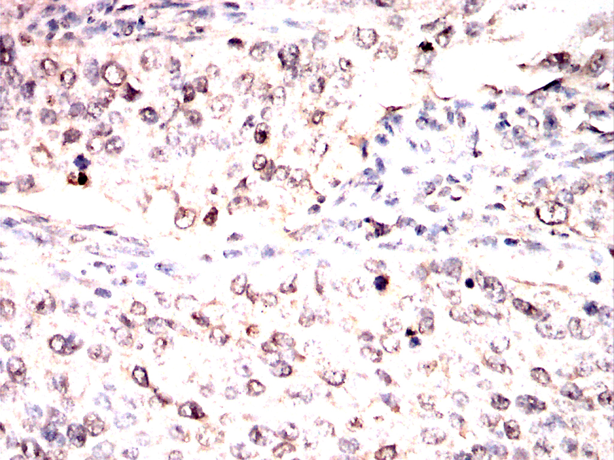 IHC